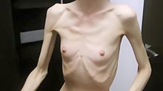 Anorexic Denisa posing and has ribs touched